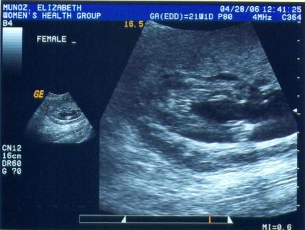 Look it's a girl